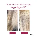 7.webp